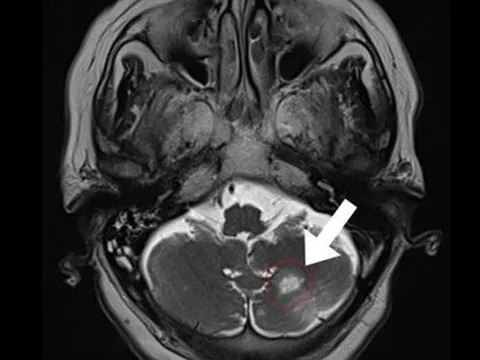 TP HCM: Sốc nhiệt, cụ bà chạy lòng vòng sân bay khi vừa nhập cảnh
