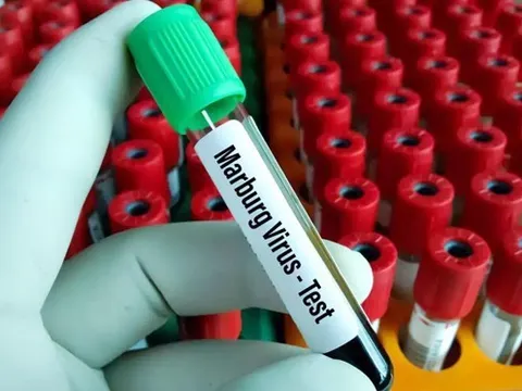 Ngành y tế yêu cầu người dân theo dõi và chủ động bệnh do virus Marburg