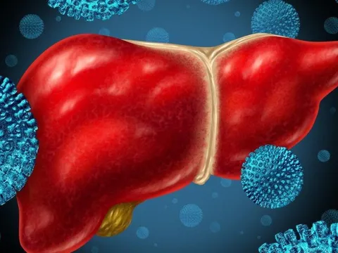 Những thứ phá hủy gan chẳng kém rượu bia