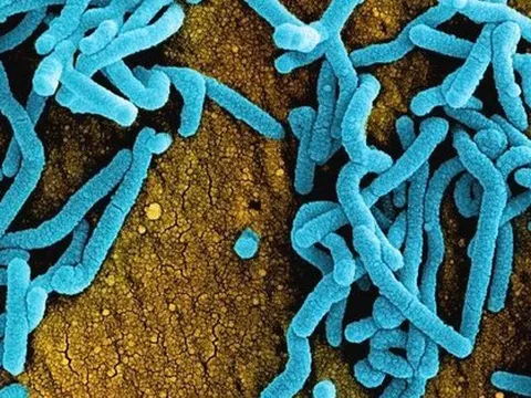 Virus Marburg gây tử vong cao nhưng không dễ lây