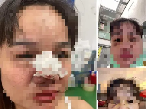 Người nổi tiếng kêu gọi từ thiện ở Quảng Nam bị "bốc phốt ăn chặn tiền" nói gì?