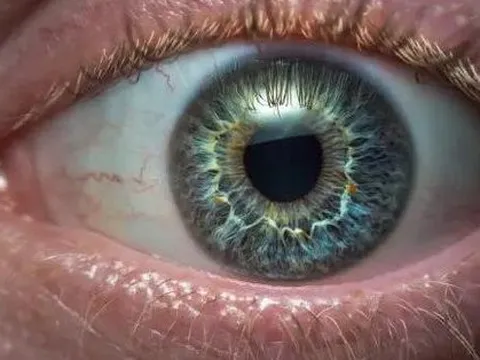 Dấu hiệu ở mắt cảnh báo ung thư dạ dày