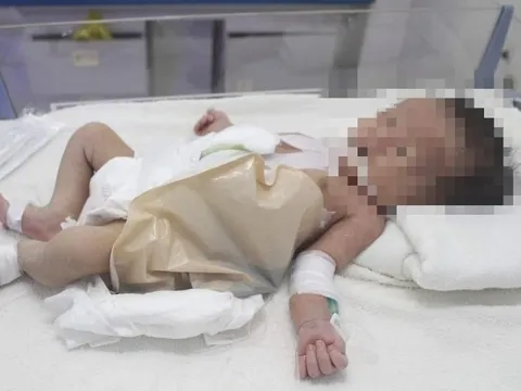 Phẫu thuật thành công trẻ sơ sinh không có hậu môn