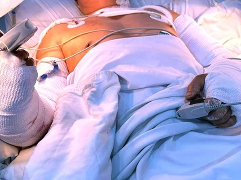 Hy hữu bệnh nhân bị đứt lìa 2 cẳng tay được nối thành công
