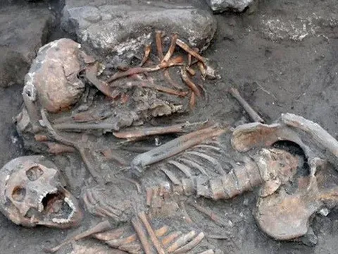 "Phẫu thuật não" có thể đã tồn tại từ 3.400 năm trước