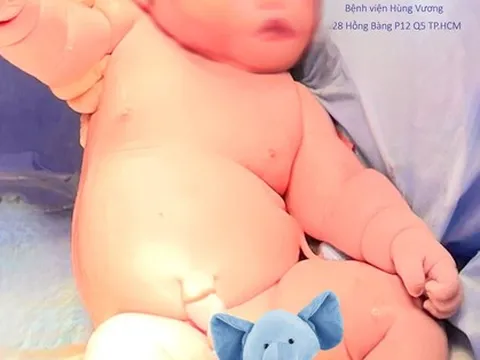 Bé trai chào đời nặng gần 5,8kg, tương đương trẻ 2 tháng tuổi