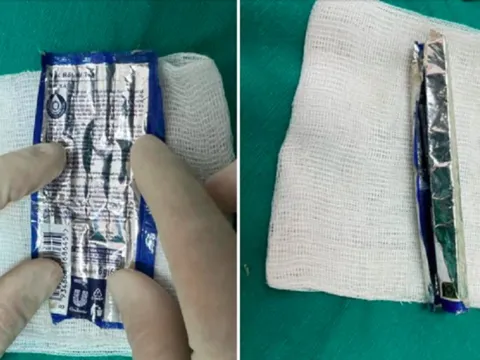 Tá hỏa phát hiện vỏ kem xả tóc trong niệu đạo cụ ông