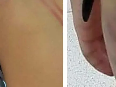 Chủ tịch tỉnh Cà Mau chỉ đạo xử lý nghiêm vụ mẹ kế bạo hành con riêng của chồng