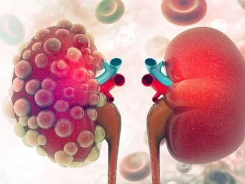 2 dấu hiệu trên da cảnh báo chức năng thận suy giảm