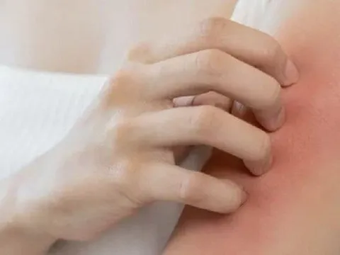 Dấu hiệu trên da tưởng bình thường nhưng có thể cảnh báo 4 bệnh nguy hiểm