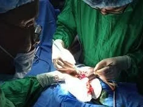 Hi hữu: Người đàn ông bị cương cứng 'cậu nhỏ' suốt 42 giờ