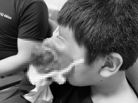 Xót xa bé trai 4 tuổi bị "u quái khổng lồ" tại hốc mắt che gần hết mặt