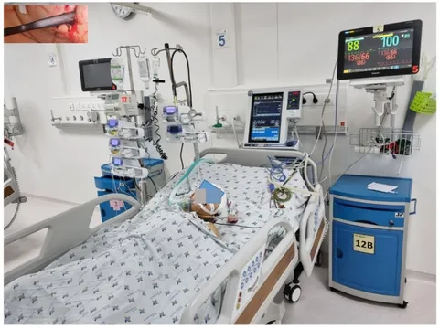 Bé gái bị tay thắng xe đạp cắm vào hốc mắt đã hồi phục kỳ diệu