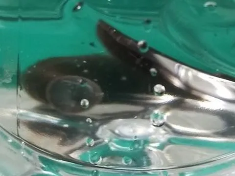 Vì sao đỉa sống trong khí quản cụ bà suốt 2 tháng mà không hay biết?