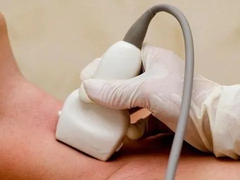 Thiếu i-ốt gây hậu quả nặng nề