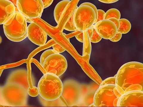 Nấm gây chết người “đáng lo ngại” lây lan khắp nước Mỹ với tốc độ báo động