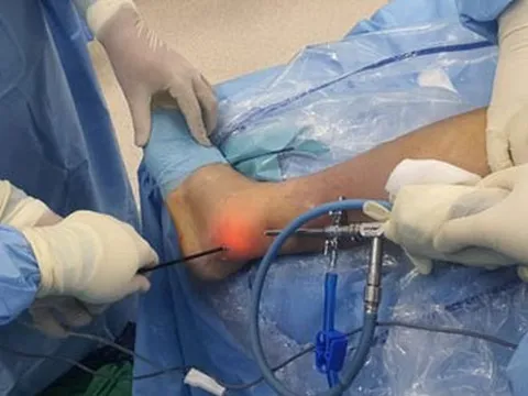 Nhập viện vì tập sai cách