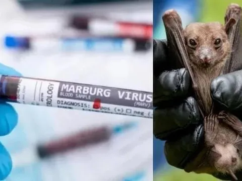 Bệnh do virus Marburg lây nhiễm thế nào?