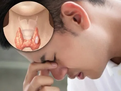 Tưởng đau đầu do mất ngủ, ai ngờ mắc ung thư tuyến giáp