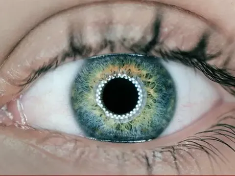 Kiểm tra mắt bằng AI có thể dự đoán chính xác cơn đau tim gây tử vong trong tương lai