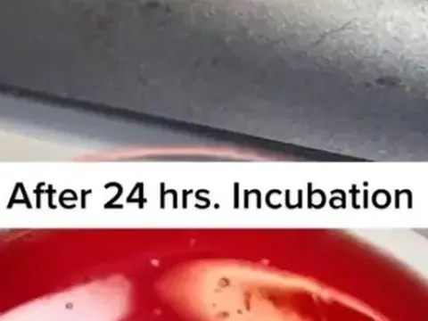 Nhiều vi khuẩn cực kỳ nguy hiểm cho sức khỏe 'ẩn nấp' trên bồn cầu, màn hình điện thoại