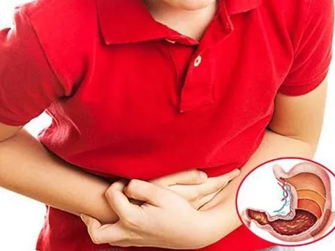 Những thói quen tưởng vô hại tàn phá dạ dày