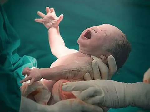 Mẹ bầu đẻ thường được nhưng sợ đau nên muốn đẻ mổ có được không?