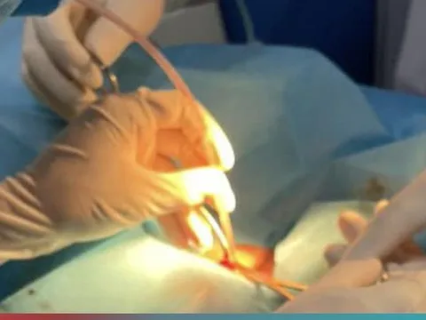 Mắc uốn ván nguy kịch từ vết thương do cọ xát khi đi dép