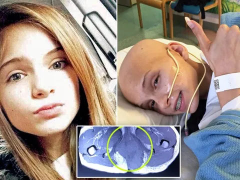 14 tuổi mắc ung thư, chỉ có 20% cơ hội sống sót: Cô gái chiến thắng bệnh tật mong muốn trở thành bác sĩ cứu người