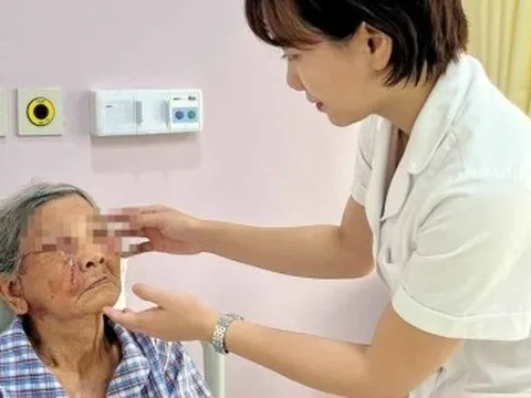 Phát hiện ung thư da từ nốt ruồi dưới mi