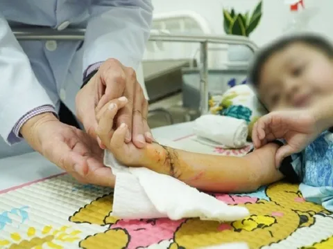 Nối liền cánh tay bị đứt lìa cho bé trai 5 tuổi