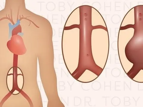 Từ đau bụng đến tử vong chỉ 2 ngày, phải cảnh giác với căn bệnh cực nguy hiểm này