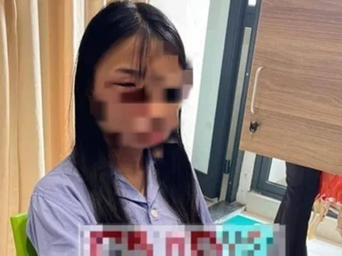 Giám định thương tích nữ sinh lớp 8 bị đánh hội đồng