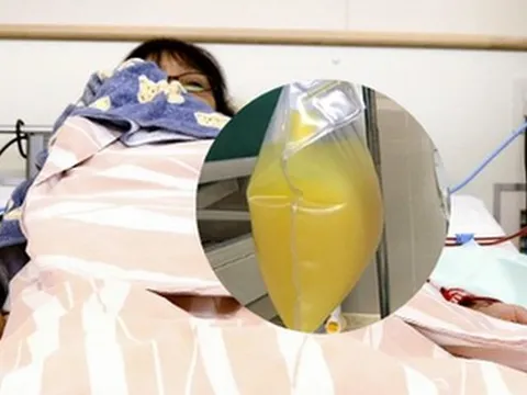 Gần 2 lít “dầu” trong máu, người phụ nữ suýt mất mạng vì món khoái khẩu từ thịt lợn