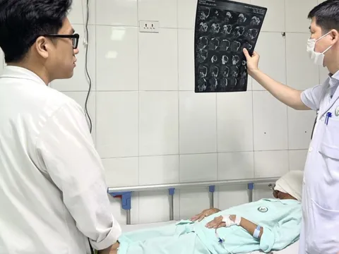 Người phụ nữ mang khối u vùng mặt to như chiếc đầu thứ hai