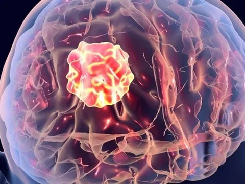 Bác sĩ tiên lượng chỉ sống thêm 1-2 năm, người đàn ông vẫn khỏe mạnh sau gần 2 thập kỷ