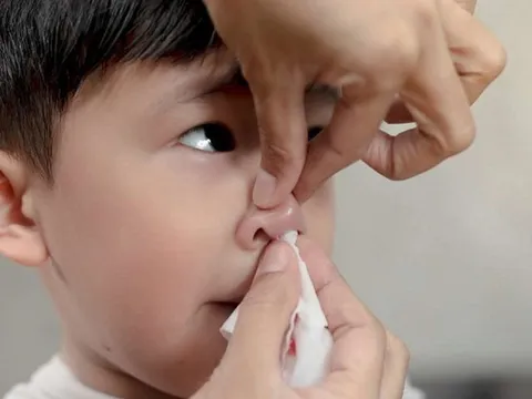 Chuyên gia cảnh báo gần 20% trẻ dưới 5 tuổi bị thiếu máu