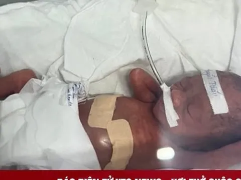 Sự sống kỳ diệu của bé trai sinh non nặng 600g