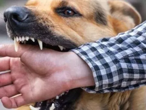 Bé gái 3 tuổi tử vong sau khi bị chó nhà cắn