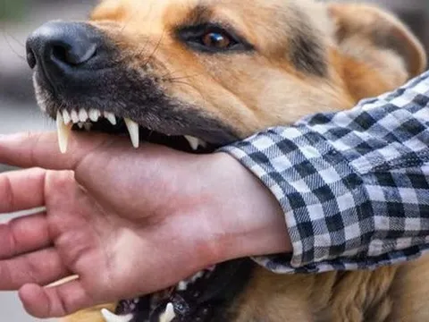 Bình Thuận: Một bệnh nhân tử vong do bị chó cắn, nghi mắc bệnh dại