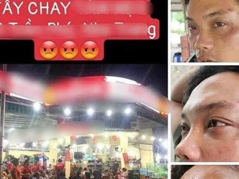Xác minh vụ nhân viên quán hải sản ở Nha Trang bị tố đánh du khách