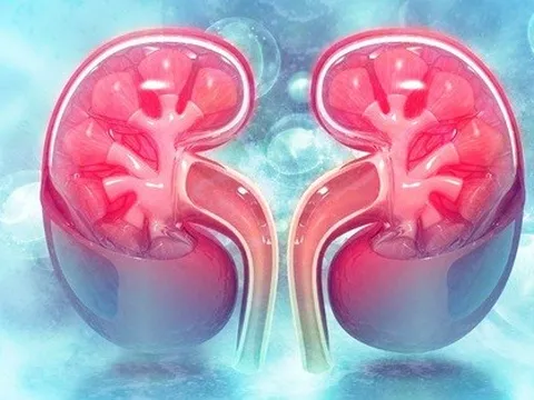 2 loại nước nếu uống quá nhiều khi trời nắng nóng sẽ khiến thận bị tổn thương nhanh chóng