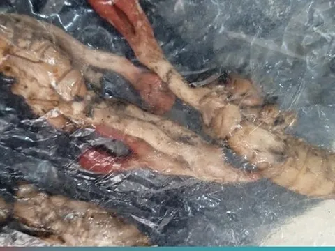 Suýt tử vong vì ăn nhầm xác nhộng ve sầu mà tưởng đông trùng hạ thảo