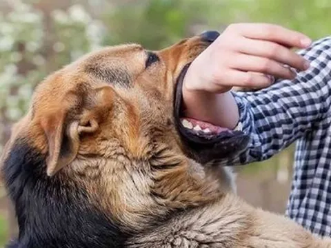 Chủ quan khi bị chó nhà cắn, người phụ nữ qua đời sau 3 tháng