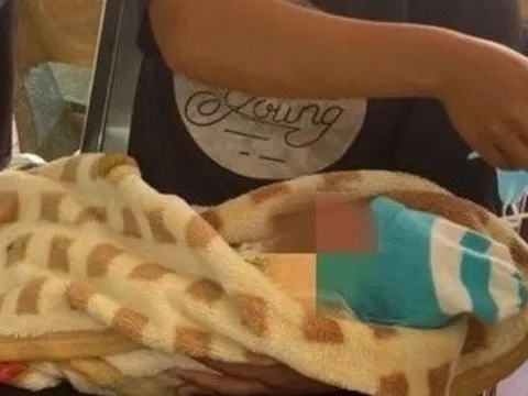 Vừa chào đời bé đã phải nhập viện khâu 21 mũi vì sai lầm của người lớn