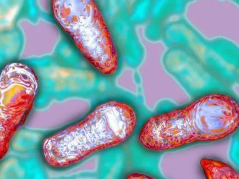 Phòng ngừa ngộ độc Botulinum như thế nào?