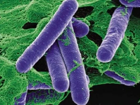 Vi khuẩn gây ngộ độc Botulinum tấn công cơ thể như thế nào?