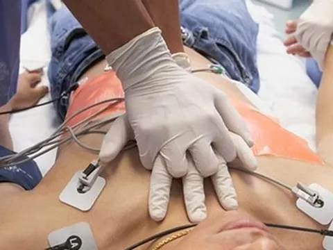 Sau cuộc nhậu, nam thanh niên đột ngột lên cơn nhồi máu cơ tim