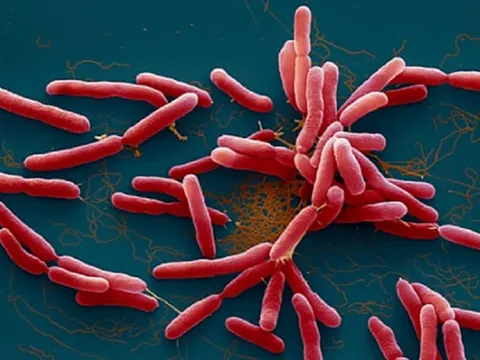 Đắk Lắk ghi nhận một bệnh nhi tử vong vì bệnh Whitmore