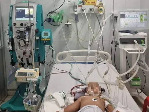 Hội chẩn từ xa cứu bệnh nhi mắc bệnh tay chân miệng nguy kịch